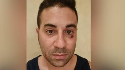 Подросток избил мужчину на глазах у детей за просьбу надеть маску в лифте эйлатского отеля - vesty.co.il - Израиль
