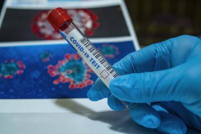 Моше Эйнат - Ученые узнали, как убить коронавирус за 2 секунды и мира - cursorinfo.co.il - Израиль - Jerusalem