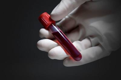 Изобретенный в Израиле безыгольный анализ крови будет использоваться в космосе - cursorinfo.co.il - Израиль