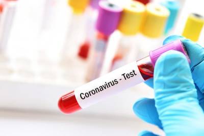 В аптеках Израиля появятся экспресс-тесты на коронавирус - cursorinfo.co.il - Израиль