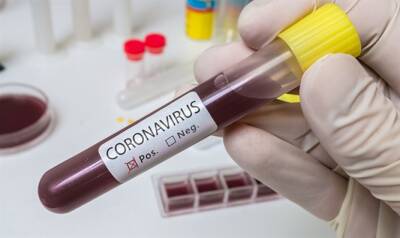 Число активных заболевших коронавирусом достигает почти 9 000, госпитализировано 140 пациентов - 7kanal.co.il - Израиль