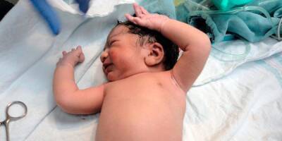 В Израиле родилась девочка с эмбрионом в животе - detaly.co.il - Израиль