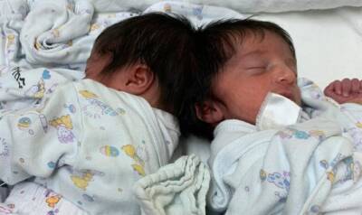 После нескольких месяцев подготовки в больнице «Сорока» удалось разделить годовалых близнецов со сросшимися головами - 7kanal.co.il