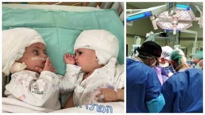 В Израиле провели уникальную операцию по разделению сиамских близнецов - skuke.net - Израиль - Лондон