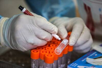 Новый комплекс тестирования на антигены будет работать 24 часа в сутки - cursorinfo.co.il - Израиль