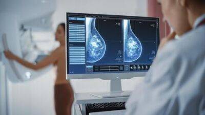 Где в Израиле больше шансов вылечиться от рака груди - vesty.co.il - Израиль