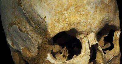 Дело рук мистиков или обычных врачей. Что не так с 2300-летним черепом, который нашли в Турции - focus.ua - Израиль - Украина - Китай - Турция