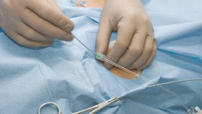 Кардиолог про смерть на операционном столе: "Аппарат должен был включиться через полминуты" - vesty.co.il - Израиль - Адлер