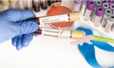 Министерство здравоохранения сообщает, что количеством новых случаев коронавируса, как и количество тяжелых случаев, продолжает снижаться - 7kanal.co.il - Израиль