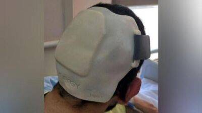 Впервые: израильские врачи восстановили разбитую голову жертвы теракта с помощью напечатанного шлема - vesty.co.il - Израиль - Израильские