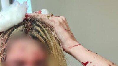 Пациент разбил голову женщине-врачу в Беэр-Яакове за просьбу выйти из кабинета - vesty.co.il - Израиль - Беэр-Яакова - Беэр - Из