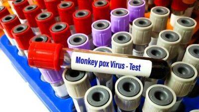 Израиль готовится к вакцинации от оспы обезьян - vesty.co.il - Израиль - Сша