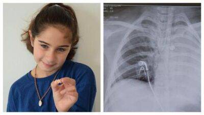 9-летняя школьница вдохнула молочный зуб на уроке и потеряла сознание - vesty.co.il - Израиль