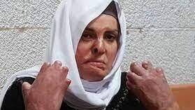 Террористка с обожженным лицом: мировые СМИ нашли себе палестинскую героиню - vesty.co.il - Израиль - с. 2015 Года