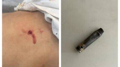 8-летний мальчик играл с гильзой, и она разорвалась у его сердца - vesty.co.il - Израиль