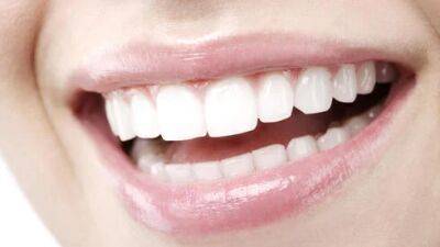 Белоснежная улыбка в день 8 марта: как отбелить зубы самостоятельно - vesty.co.il - Израиль