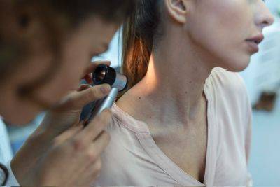 Израильские врачи предупреждают: рак кожи может развиться у каждого второго - cursorinfo.co.il - Израиль