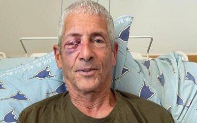 Амихай Эшед - Резервист ВВС, повредивший глаз во время акции протеста, не собирается «служить диктатуре» - nashe.orbita.co.il - Тель-Авив