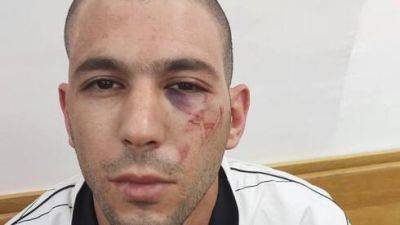 Клеймо на лице: полиция Израиля не должна превратиться в путинский ОМОН - vesty.co.il - Израиль