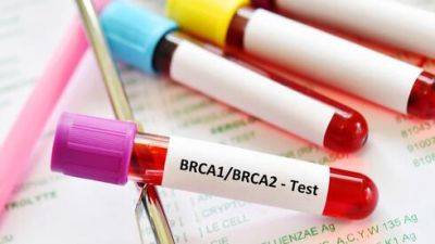 Почему в Израиле врачи направляют женщин на анализ BRCA - vesty.co.il - Израиль - Иерусалим