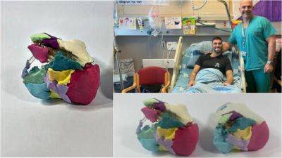 Раненого бойца ЦАХАЛа спасли от ампутации с помощью напечатанного колена - vesty.co.il - Израиль