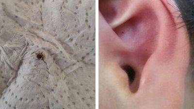 Новая напасть: клещи залезают в уши детям в Израиле - vesty.co.il - Израиль