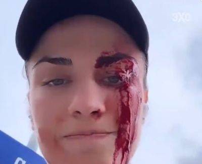 На чеченскую спортсменку напали в Швейцарии - mignews.net - Швейцария