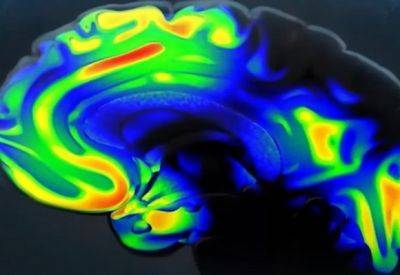 Препарат по лечению болезни Альцгеймера, показывает положительные результаты - mignews.net - Сша